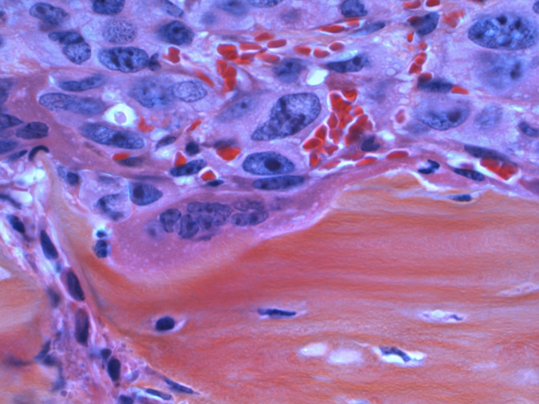 découvrez comment les tests sanguins révolutionnent la détection du cancer, offrant des diagnostics précoces et améliorant les chances de traitement. informez-vous sur les dernières avancées scientifiques et les avantages de ces tests cruciaux dans le domaine de la santé.