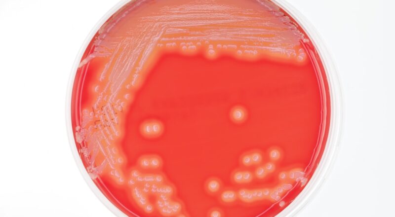 découvrez tout ce qu'il faut savoir sur le staphylococcus, une bactérie omniprésente pouvant causer diverses infections. apprenez à reconnaître les symptômes, les modes de transmission et les moyens de prévention pour protéger votre santé.