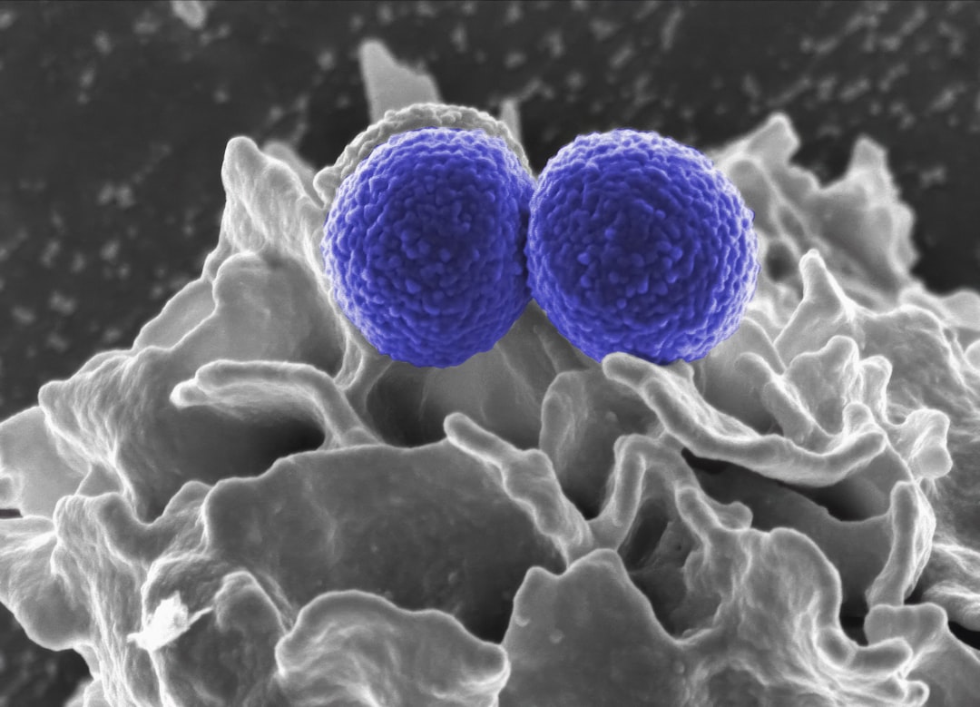 découvrez tout sur les staphylocoques, des bactéries omniprésentes pouvant causer diverses infections. apprenez à les identifier, leurs symptômes, ainsi que les méthodes de prévention et de traitement. informez-vous pour mieux protéger votre santé.