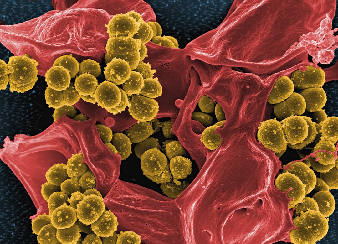 découvrez tout sur le staphylococcus, un groupe de bactéries aux multiples facettes. explorez leurs caractéristiques, leur impact sur la santé humaine et les infections qu'ils peuvent provoquer. informez-vous sur les méthodes de prévention et de traitement pour rester en sécurité face à ces micro-organismes.