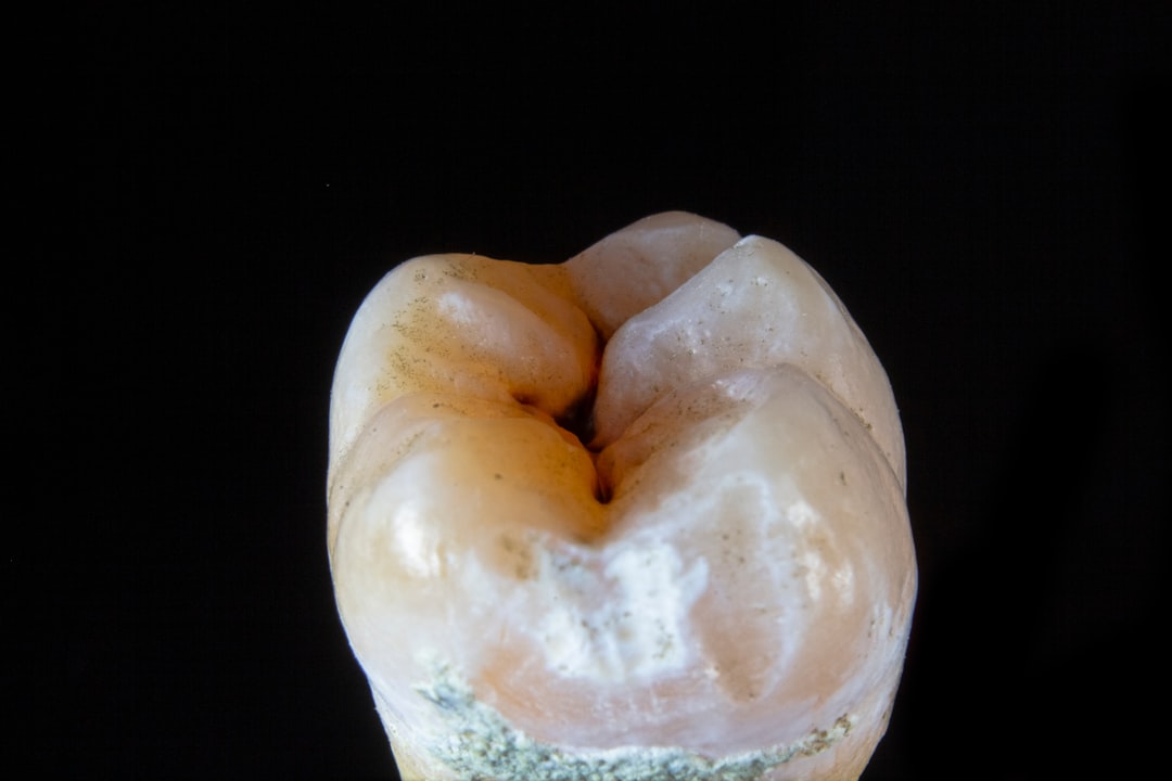 découvrez tout sur les œufs de dinde : leurs bienfaits nutritionnels, des recettes délicieuses et des conseils pour les cuisiner. un trésor culinaire à explorer pour diversifier vos plats et enrichir votre alimentation.