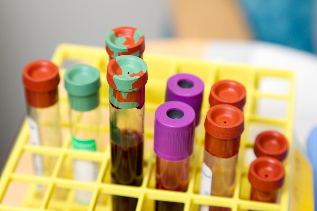 découvrez tout ce qu'il faut savoir sur les tests sanguins : leur importance, les types disponibles, et comment ils peuvent aider à diagnostiquer des maladies. informez-vous sur les procédures, les résultats et l'interprétation des analyses pour mieux comprendre votre santé.